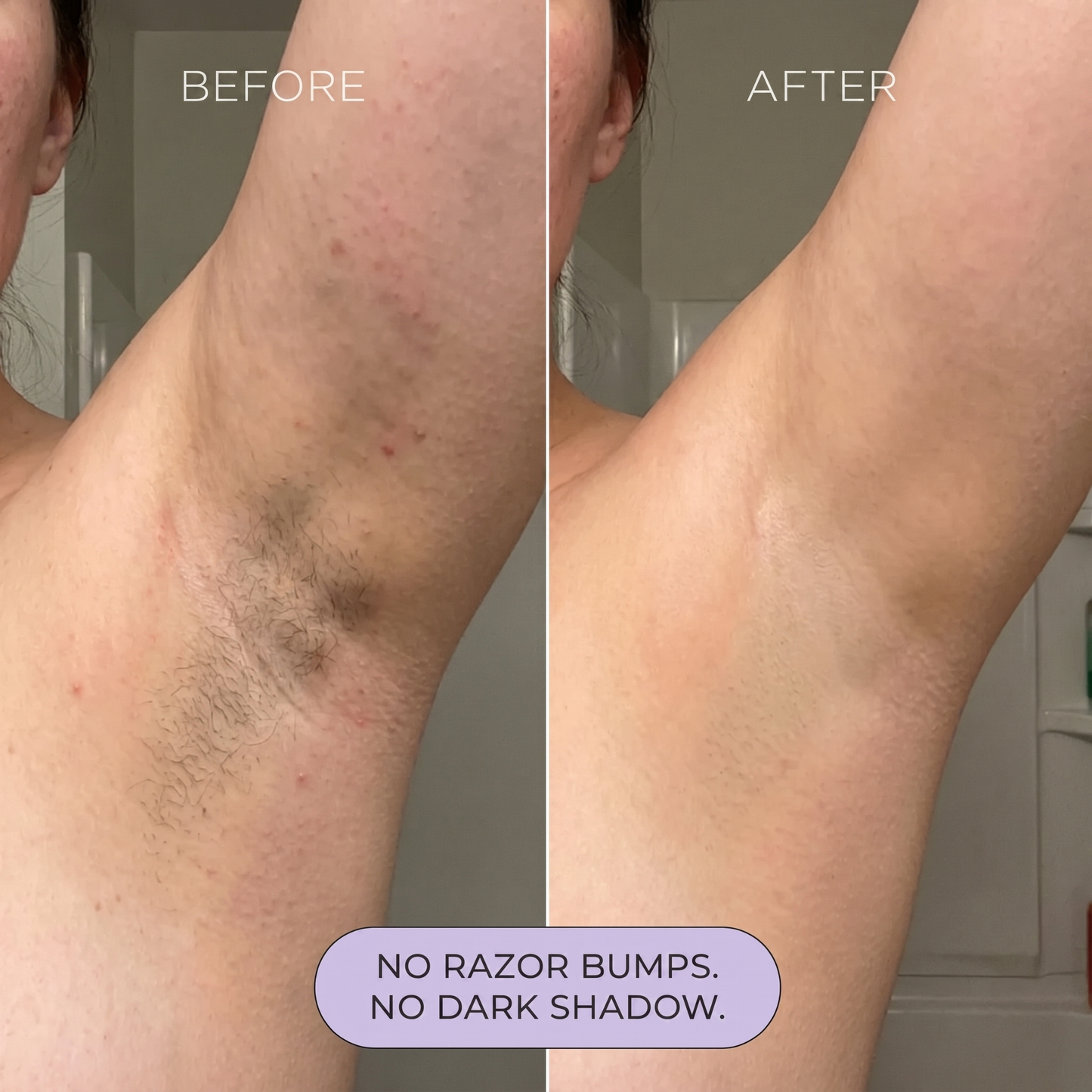 Luxari ™ Hair Removal Spray -painless &amp; Easy Use